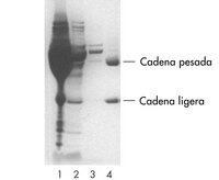 Se purificó IgG monoclonal de ratón en ascites con una columna PROSEP-A para centrífuga. (Línea 1: ascites no purificado. Línea 2: ascites fluyendo. Línea 3: lavado. Línea 4: 5 µg de anticuerpo purificado). Cortesía de Exalpha Biologicals.